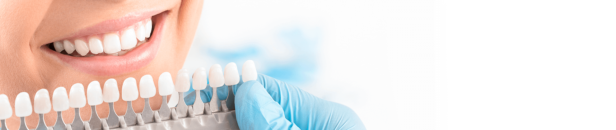 Veneers in Lake Oswego, Oregon